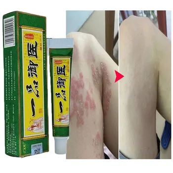 Dermatite Anti Infecção Fúngica Da Pele, Dermatite De Creme De Psoríase Eczema Creme Urticária Cuidados Da Pele, Creme